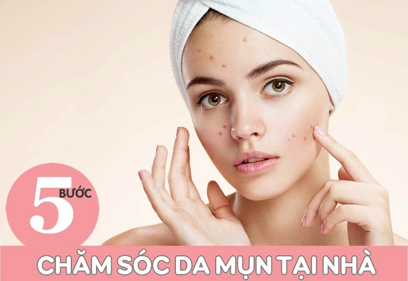 Quá Trình Điều Trị Mụn Không Được Bỏ Qua Các Bước Chăm Sóc Da